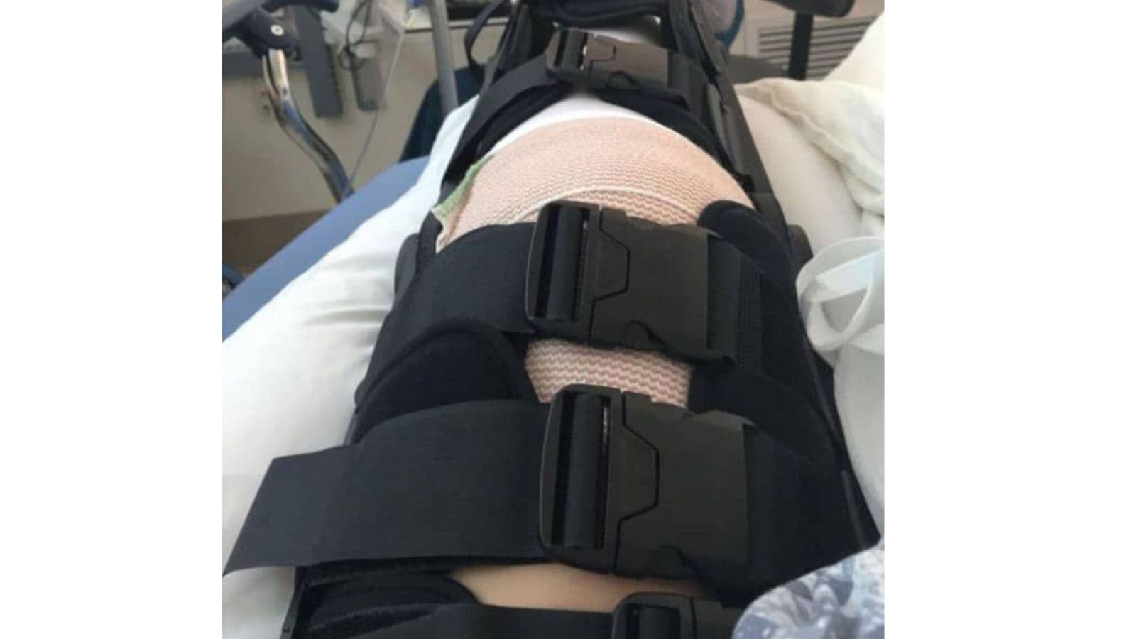 I Was Hit By A Motorcycle. Broken Leg. Broken Arm. Hospital Bill $72,000.