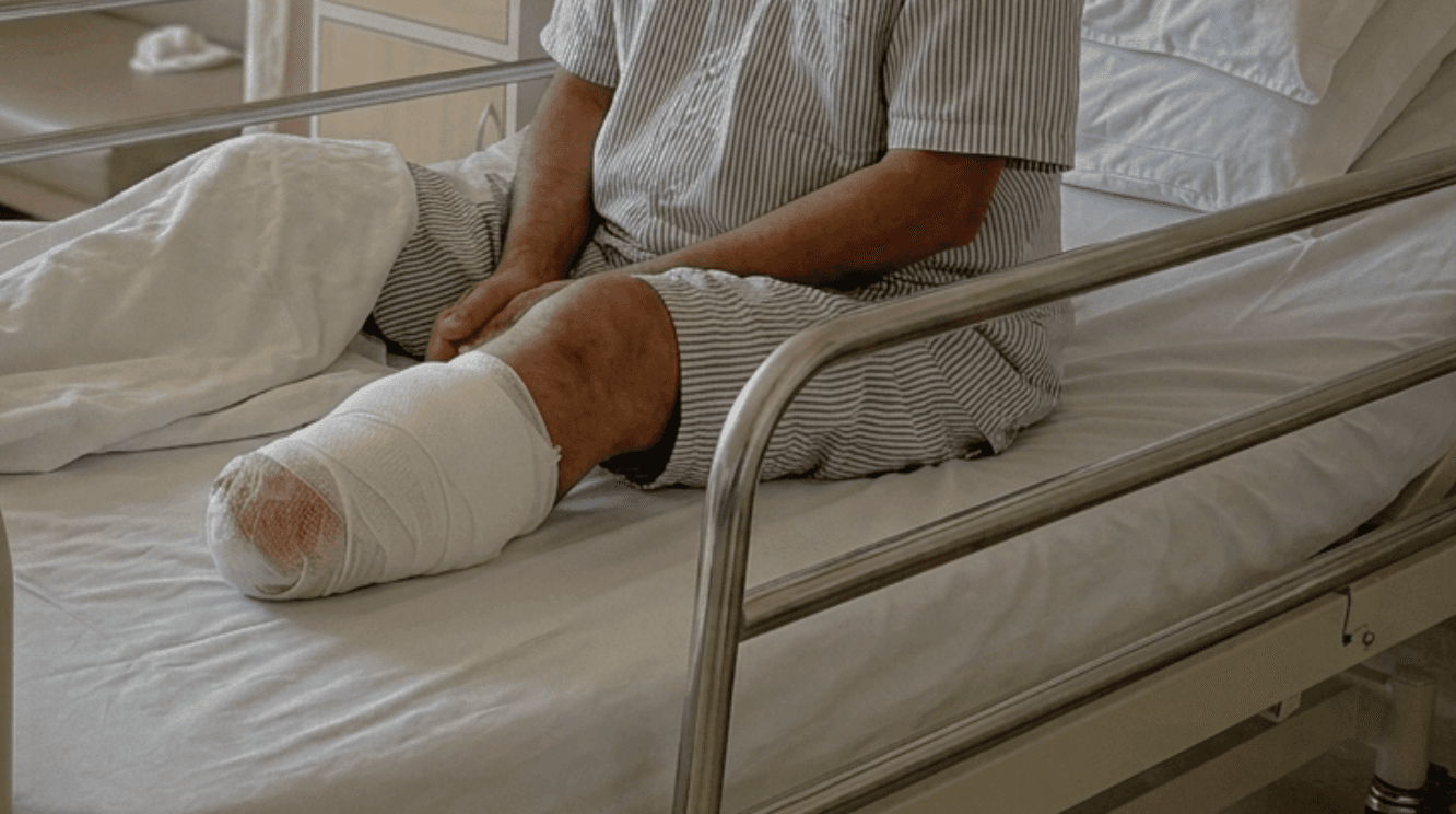 My Father Leg Got Amputated Because Of Diabetes Now He Needs Prosthetic Leg